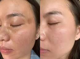 糖尿病有救了！每天空腹喝, 血糖從16降到7.6，效果驚人！可惜知道的人太少！