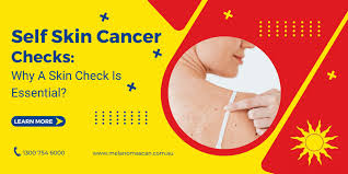 Image result for Self Skin Exam