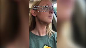 Woman discovers cancerous tumour in neck after trying Gua Sha