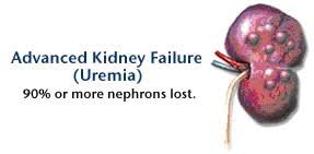NEJM]Uremia @ 快樂小藥師 Im pharmacist nichts glücklich :: 痞客邦 :: さん