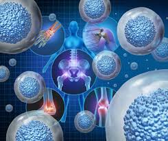 Who Makes the Ideal Candidate for Stem Cell Therapy?