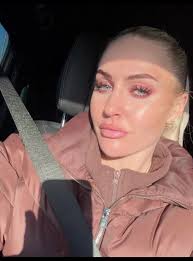 Returning to Running After Ankle Injury