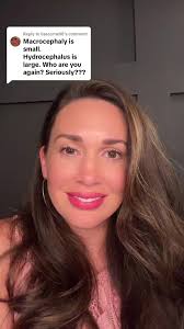 Replying to @lisacornell8 #hydrocephalusawareness #macrocephaly #doctor  #greenscreen