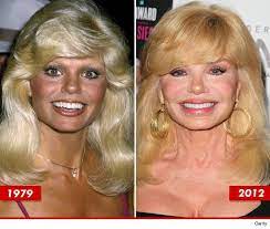 Facelift probably also was taken by loni anderson plastic surgery to keep her face epidermis stronger and eternal. Pin On Good Genes Or Good Docs