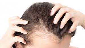 The hair is the symbol of our glory. Hair Loss Dream Meaning And Symbolism