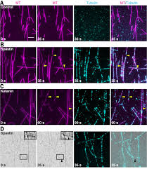 Piszczek has 15+ years of experience in internal medicine. Severing Enzymes Amplify Microtubule Arrays Through Lattice Gtp Tubulin Incorporation Science