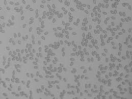 Image result for Pseudopod Ospermum