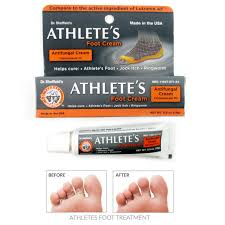 athletes foot antifungal cream