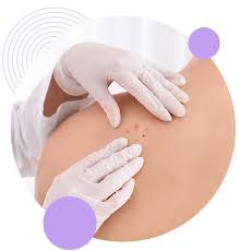 skin cancer, take a hike!™ together, we&#x27;re raising funds to reduce the incidence and mortality rates of skin cancer. Skin Cancer Clinic Norwest General Practice