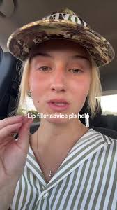 Lip Filler Advice for a Perfect Pout