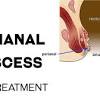 Thrombosed hemorrhoids (picture 7) is considered a separate form of the disease. Https Encrypted Tbn0 Gstatic Com Images Q Tbn And9gct S9rvkguu2ra45oh9riie1yhqdhxbuftmjfxwpw0dlvwkclpg Usqp Cau