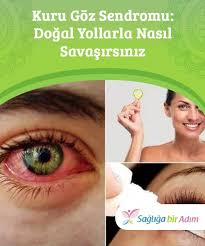 Kuru Goz Sendromu Dogal Yollarla Nasil Savasirsiniz Kuru Goz Sendromu Keratokonjonktivit Olarak Da Bilinir Bu Durum Gozleri Dry Eye Syndrome Dry Eyes Eyes