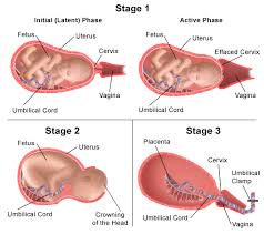 Pin On Labor And Childbirth