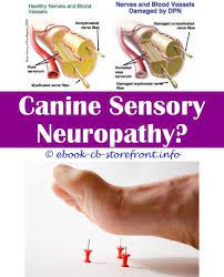 Epingle Sur Patients With Multifocal Motor Neuropathy