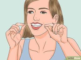 Home/blog / how to get rid of stains on dental bonding. 4 Ways To Get Rid Of Yellow Teeth Wikihow
