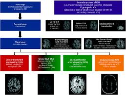 CADMUS | Neurology