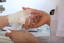 Sep 10, 2020 · absorbable sutures rapidly break down in the tissues and lose their strength within 60 days. Dissolvable Stitches How Long They Last Care Tips And Removal
