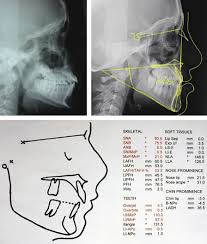 We did not find results for: 3 Investigations Pocket Dentistry