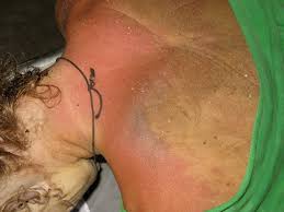 Welcome To Autopsyfiles Org Home Page Autopsy Reports Of Celebrities And Other Famous Individuals