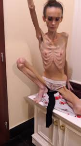 Anorexic Denisa 05-12-2022 8t00775