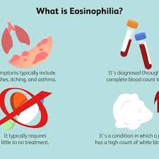 Read about stomach cancer symptoms, causes, stages, gastric cancer statistics, diagnosis, surgery, other treatment types and risk factors, like h. Eosinophilia Symptoms Causes Diagnosis Treatment