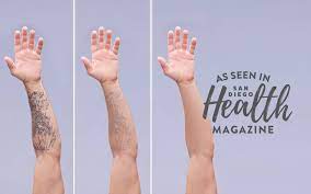 The laser is set to strike pigments that match your ink coloring the laser zaps the ink particles the heat splits the ink particles into smaller pieces How Tattoo Removal Works Scripps Health