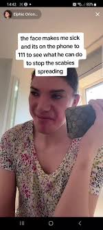 #elphabaoriondoherty #elphabadoherty #elphabaorion #mariadoherty #cla  #claroots #lol #111 #scabies #bedbugs