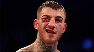 And duty calls on saturday night at the coventry skydome, where molina takes on sam eggington in a middleweight clash for the wbc silver title. Can Sam Eggington Become Matchroom Boxing S Biggest Success Story Boxing News