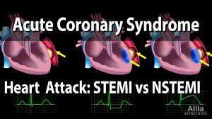 An nstemi differs from a stemi, which is the most common type of heart attack, by causing less damage to a. Acute Coronary Syndrome Unstable Angina Nstemi And Stemi Heart Attack Animation Youtube