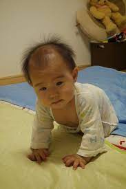 ちいままの育児書: なかなか髪の生えない赤ちゃん（１歳までの記録）笑