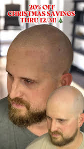 🎄‘Tis the Season to END BALDNESS FOR GOOD! New Man SMP⭐️ provides the most  realistic and long-lasting results for hairline repair and baldness.  Schedule your free consultation today to learn more and ...