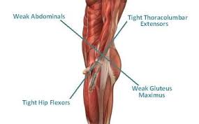 The hip muscles encompass many muscles of the hip and thigh whose main function is to act on the thigh at the hip joint and stabilize the pelvis. Low Back Pain And Rock Climbing The Climbing Doctor