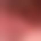 Image result for Uvulitis