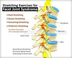 Pin On Facet Joint Pain