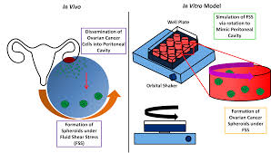 When this process begins, there may be no or only vague symptoms. Cells Free Full Text A Dynamic Culture Method To Produce Ovarian Cancer Spheroids Under Physiologically Relevant Shear Stress Html