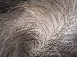 How to check yourself for lice. What To Do About Head Lice Embarrassing Problems