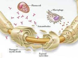 Neuropathie Durch Chemotherapie Praxis Margareten