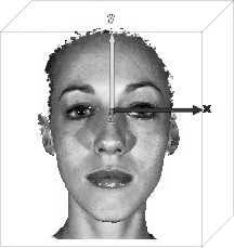 3-D analysis of facial asymmetry in children with hip dysplasia