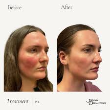 Please help us welcome Jordan Sparrow, PA-C to our team! 🎉🤗 Jordan  graduated in 2024 from Bethel University with a Masters of Science in  Physician Assistant Studies. She grew up in Fort