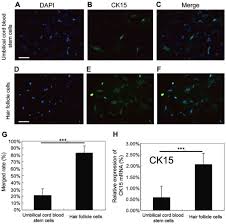 Yeah it is normal for few hair to fall like that. Isolation And Characterization Of In Vitro Culture Of Hair Follicle Cells Differentiated From Umbilical Cord Blood Mesenchymal Stem Cells