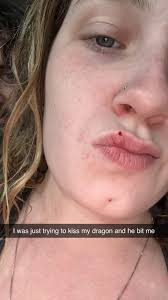 Bearded dragon bites owner during playtime incident