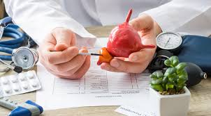 Reviews common tests for these conditions, as well as treatment side effects. Cirurgia Para Cancer De Prostata Quando Essa E A Melhor Opcao Dr Leonardo Ortigara