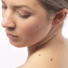 Lazerle Ben Aldirma Kadinlar Kulubu Archives Estetik Cerrahi Ve Ameliyatsiz Estetik Doc Dr Serkan Yildirim