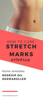 5 Best Rosehip Oils For Stretch Marks Derma Roller Stretch Marks Rosehip Oil