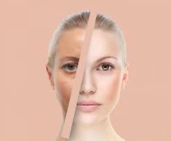 как избавиться от белых пятен на лице в домашних условиях Dlya Sebya Lyubimoj Lico Krasota Sekrety Krasoty