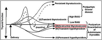 Image result for Thyroiditis