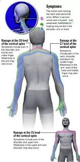 Pin On Ergonomic Advice