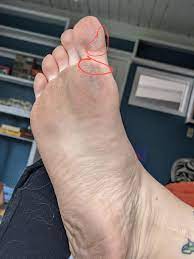 Spending A Lot Of Quarantine Totally Barefoot Mild Discomfort In Circled Areas Thoughts Barefootrunning