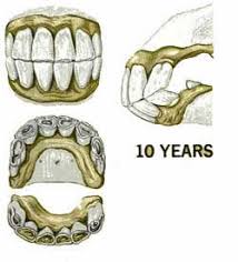 Horses Age From Teeth Growth Knowing The Signs Of Age