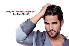 Protez Sac Fiyatlari 2019 Da Kac Lira Olacak Sac Sac Dokulmesi Erkek Saci